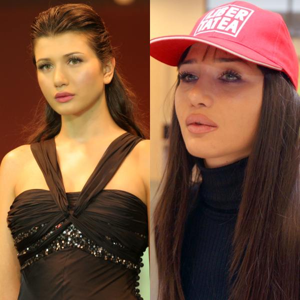 6 vedete înainte şi după mărirea buzelor. Cum arată mai bine?