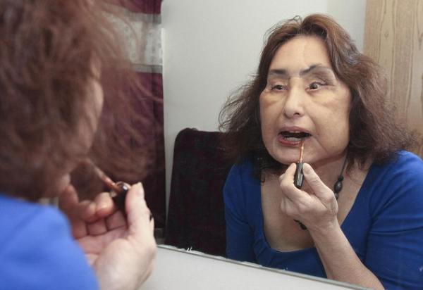 Foto: femeia care şi-a făcut transplant de faţă