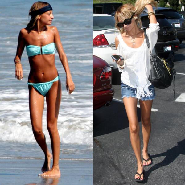 Foto: cum arătau vedetele anorexice