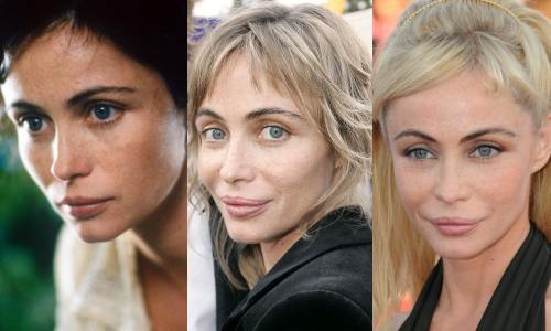Emanuelle Beart, operatii estetice nereusite