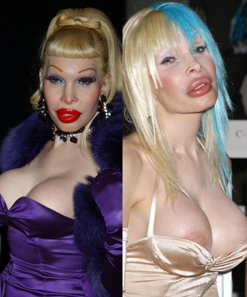 Amanda Lepore 