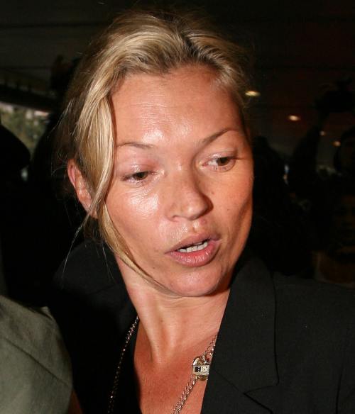 Kate Moss are tenul urat