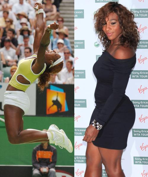 Serena Williams si+a facut operatie estetica la fund