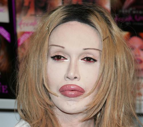 Pete Burns