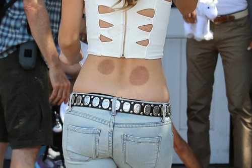 Ce pete ciudate are Annalynne McCord pe spate! Ce ar putea fi?