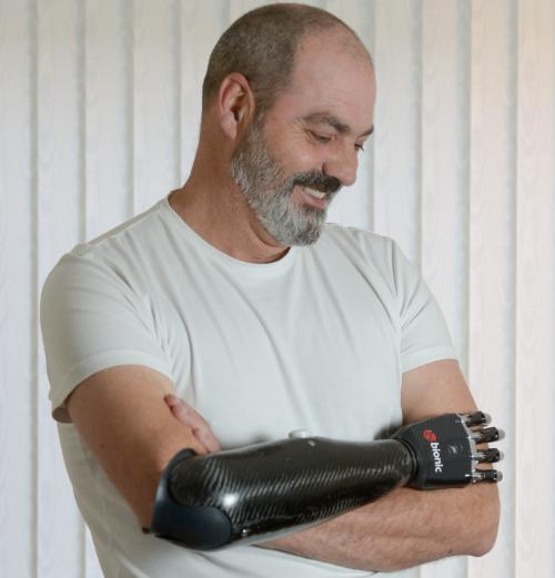 Rupt din filmele SF. Bărbatul cu braţ de Terminator
