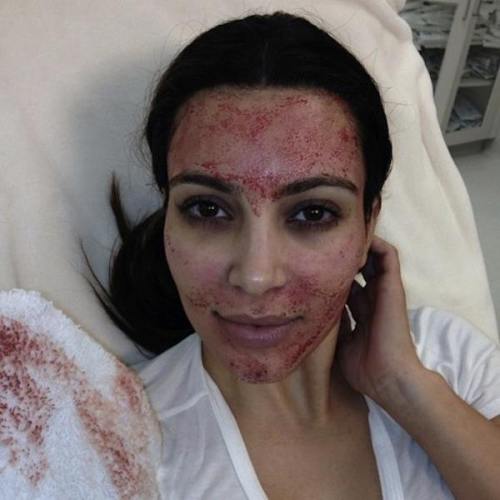 Şocant: Kim Kardashian, cu faţa plină de sânge. Vezi ce a păţit vedeta