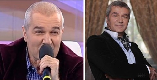 Top 5 vedete de la noi care îşi ascund chelia cu implanturi de păr