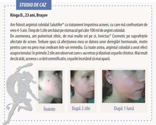 Argintul Coloidal – Singurul antibiotic natural cu efect miraculos!