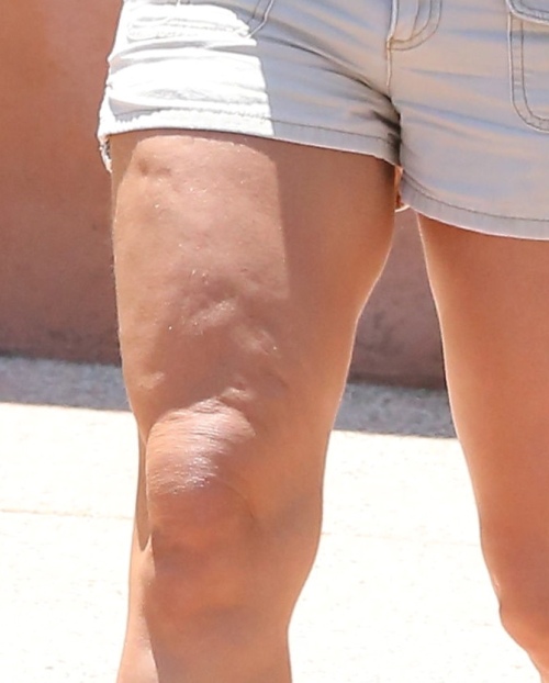 Neglijentă şi distrusă de celulită. Iată cum arată Britney Spears!