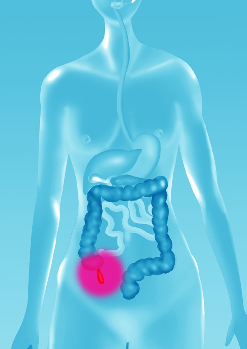 5 boli comune care sunt identificate foarte greu de către medici