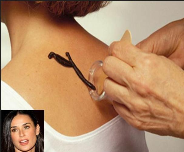 Demi Moore îşi menţine frumuseţea cu...lipitori. Tu ai încerca?