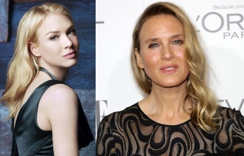 De nerecunoscut! Vedete deformate de botox