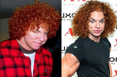 De nerecunoscut! Vedete deformate de botox