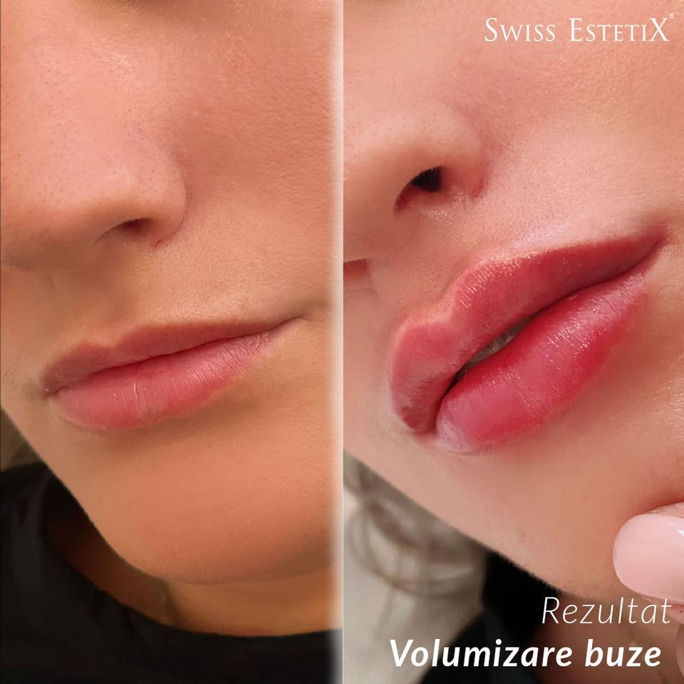 (P) Redescoperă-ți frumusețea la o clinică estetică de top!