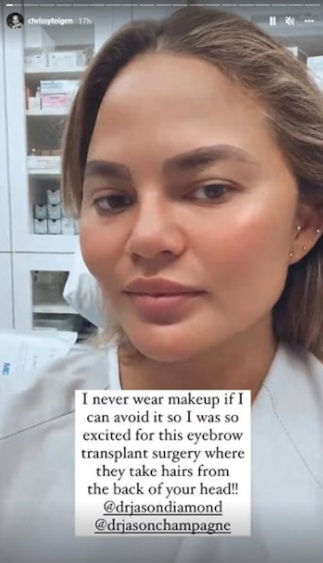 Chrissy Teigen, soția lui John Legend, și-a făcut transplant de sprâncene