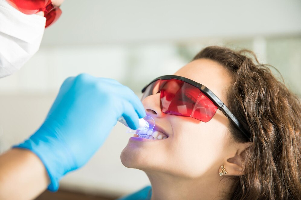 Top 5 inovații în prevenirea și tratarea cariilor dentare