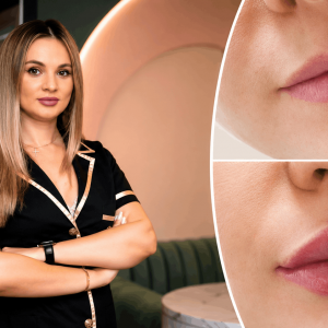 Mărirea buzelor în siguranță: Dr. Raluca Harnagea explică 7 criterii pentru alegerea medicului